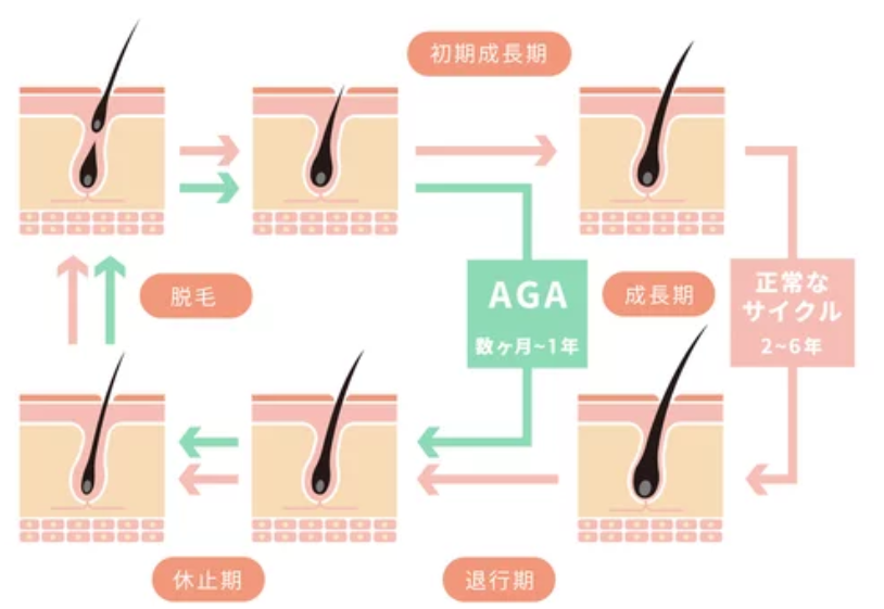 ヘアサイクルの仕組み（正常なサイクルとAGA/FAGAの比較）