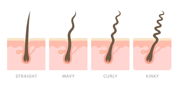 毛穴の形状変化によるうねりの変化